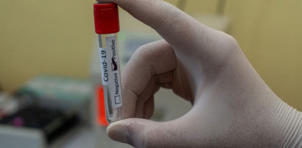 На 21 августа в регионе выявлено 127 случаев заражения коронавирусной инфекцией На 21 августа в регионе выявлено 127 случаев заражения коронавирусной инфекцией