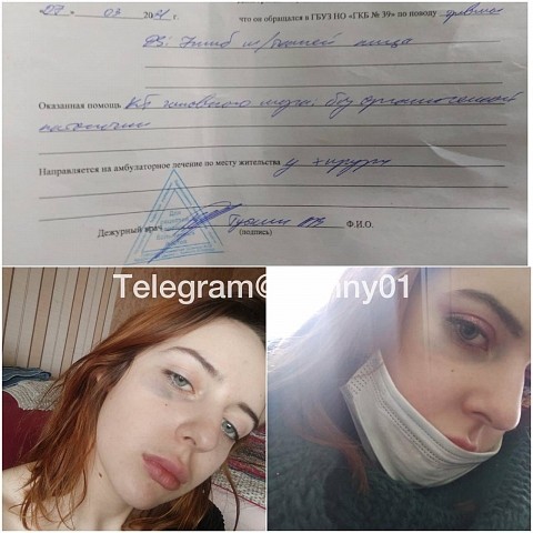 Нижегородка пожаловалась на жестокое избиение водителем такси