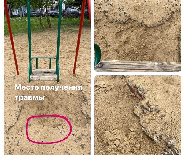 Годовалый ребенок получил травму подбородка на опасной площадке в ЖК «Зенит»
