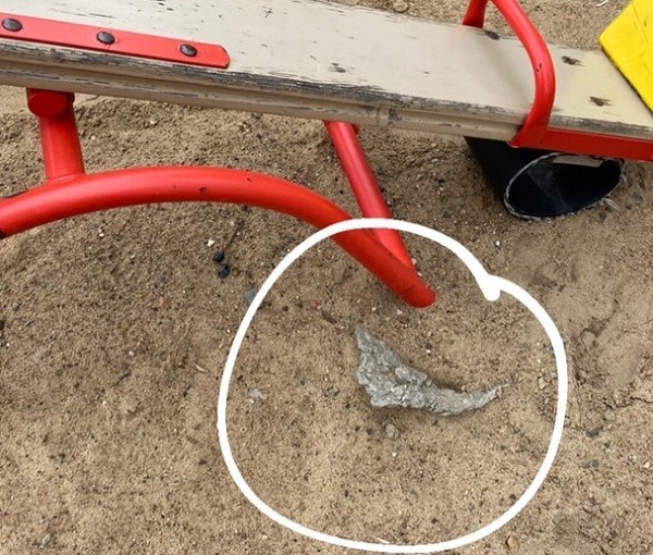 Годовалый ребенок получил травму подбородка на опасной площадке в ЖК «Зенит»